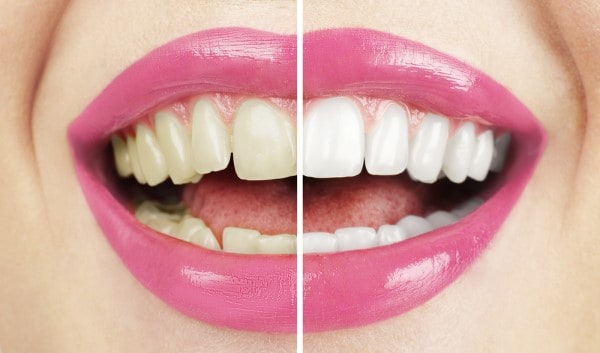 What Early Signs of Oral Cancer Should You Never Ignore Newbury?