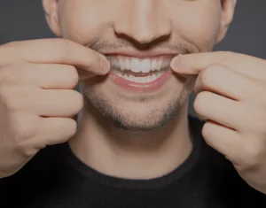 Overview of Home Teeth Whitening Kits Newbury