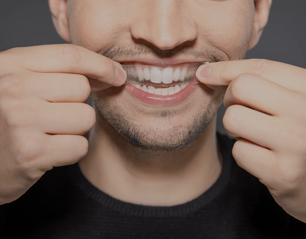 Can You Whiten Natural Teeth Without Harsh Chemicals Newbury?