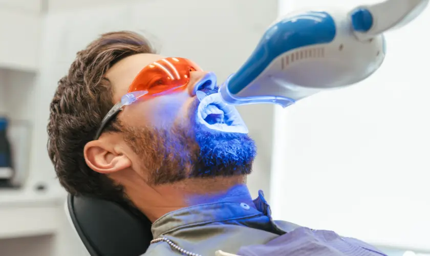 When Should You Consider Professional Whitening Instead Newbury?
