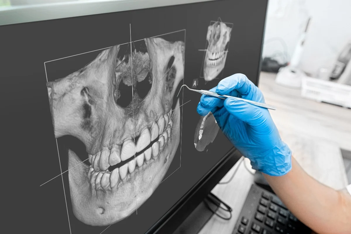 Key Benefits of 3D Printing for Patients and Dentists Newbury