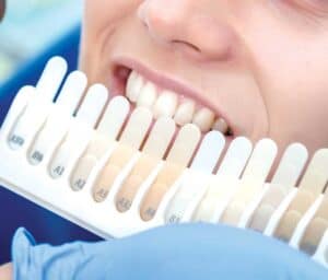 Ultimate Guide to Teeth Whitening with Natural Ingredients Newbury