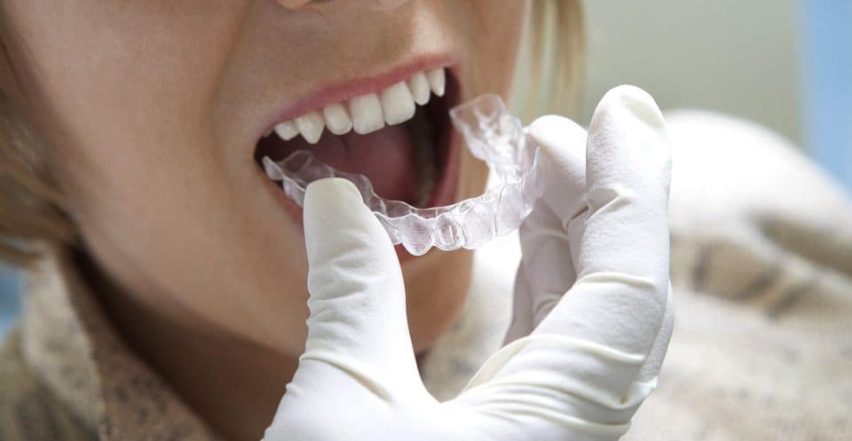 Can Bruxism Affect Your Sleep Quality Newbury