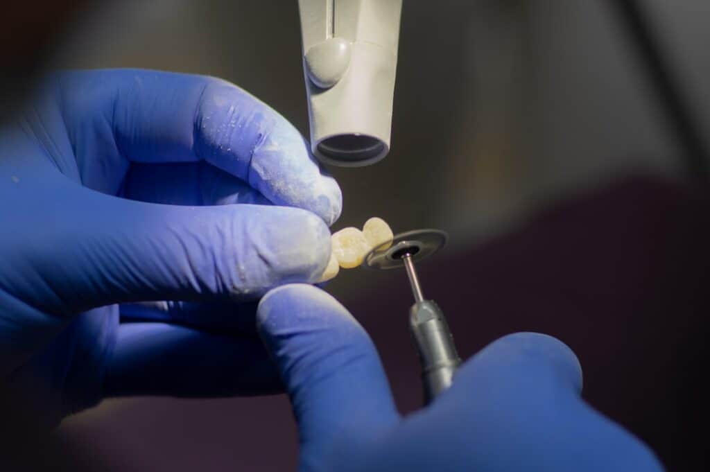 Customised Dental Solutions: Crowns, Aligners, and Implants Newbury