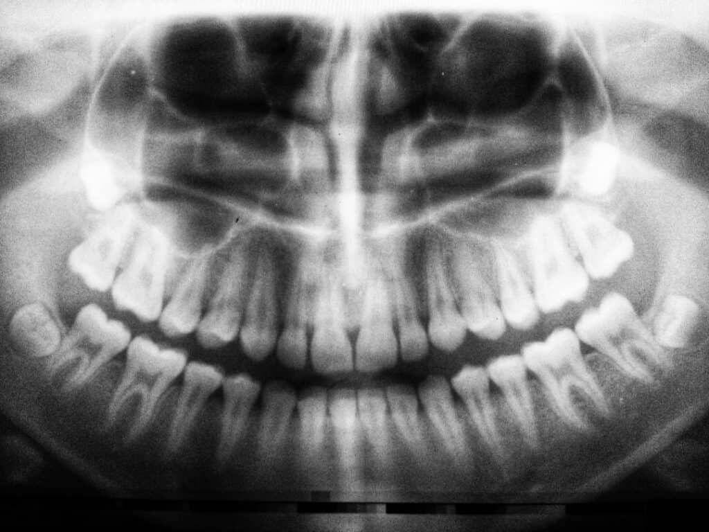 The Future of 3D Printing in Oral Healthcare Newbury