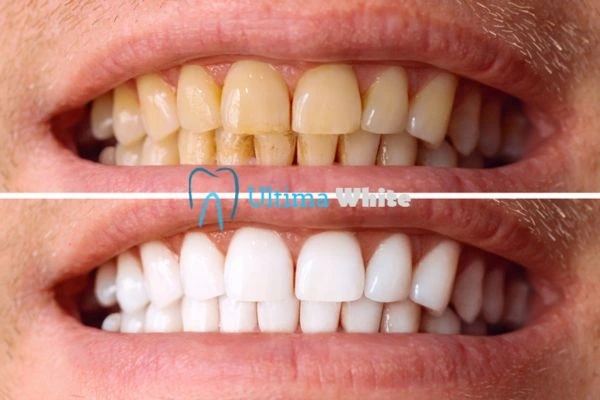 Stained Teeth and Persistent Bad Breath Newbury