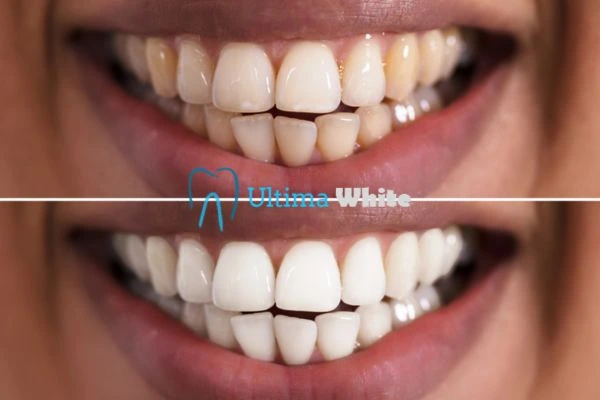 Long lasting results from Ultima White Newbury